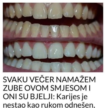 JEFTINO RJEŠENJE ZA BISERNO BIJELE ZUBE