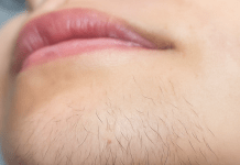 AKO STE ŽENA SA BRKOVIMA NA BRADI, OBRATITE PAŽNJU. Evo šta to znači…