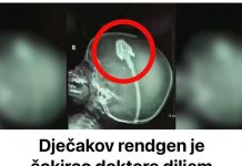 Dječakov rendgen je šokirao doktore diljem svijeta: Sad njegovi roditelji upozoravaju druge! (VIDEO)