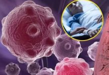 8 namirnica koje smanjuju upale i jačaju imunitet — savršen početak dana…