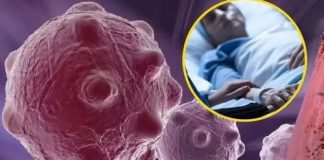 8 namirnica koje smanjuju upale i jačaju imunitet — savršen početak dana…