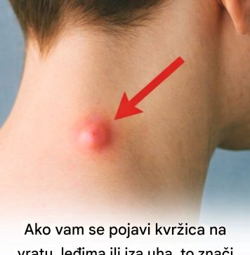 Ako vam se pojavi kvržica na vratu, leđima ili iza uha, to znači da… pogledajte više 👀👇