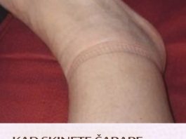 Kad skinete čarape ostanu vam tragovi na nogama: evo šta se dešava sa vašim zdravljem