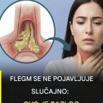 Kako ublažiti sluz u grlu: bezbedni i prirodni saveti za svakodnevno olakšanje