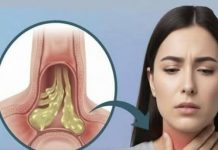 Kako ublažiti sluz u grlu: bezbedni i prirodni saveti za svakodnevno olakšanje