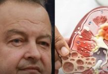Ivica dačIć ne boluje samo od upale pluća, ovu bolest je ignorisao godinama, a tiho razara organe