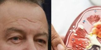 Ivica dačIć ne boluje samo od upale pluća, ovu bolest je ignorisao godinama, a tiho razara organe