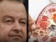 Ivica dačIć ne boluje samo od upale pluća, ovu bolest je ignorisao godinama, a tiho razara organe