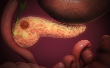 OVA 4 SIMPTOMA UKAZUJU DA IMATE RAK PANKREASA! Svrab je jedan od njih – a tek da čujete ostala tri