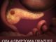 OVA 4 SIMPTOMA UKAZUJU DA IMATE RAK PANKREASA! Svrab je jedan od njih – a tek da čujete ostala tri