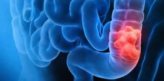 Očistite debelo crijevo slanom vodom: izbacite sve otrove nakon zatvora I to u roku od 30 minuta! (recept)