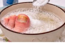 Samo 3 sastojka za žute i zadebljale nokte! GLJIVICE NA NOKTIMA KAO RUKOM ODNESENE…